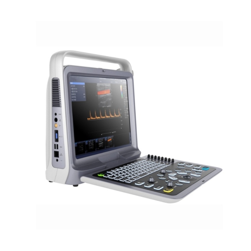 P60便携式彩色多普勒超声诊断仪